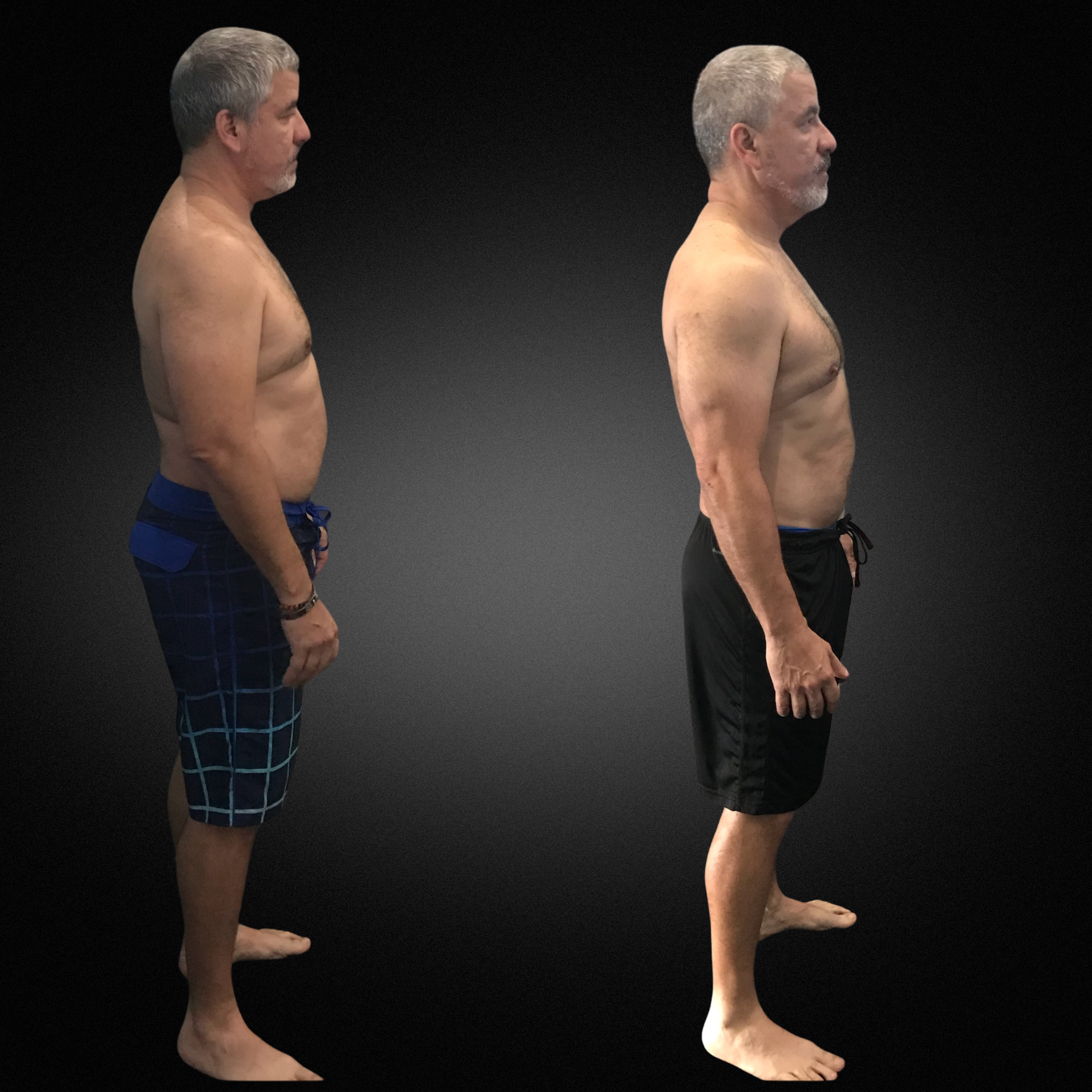 RicardoBeforeAfterTp